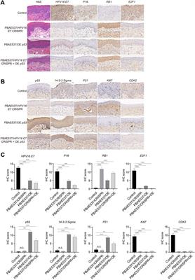 Co-Delivery of p53 Restored and E7 Targeted Nucleic Acids by Poly (Beta-Amino Ester) Complex Nanoparticles for the Treatment of HPV Related Cervical Lesions